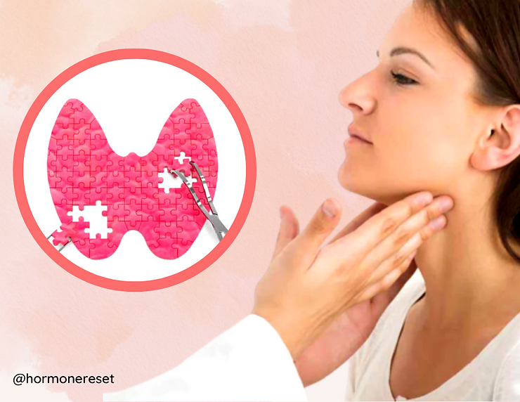 Treating Hypothyroidism With Functional Medicine Approach