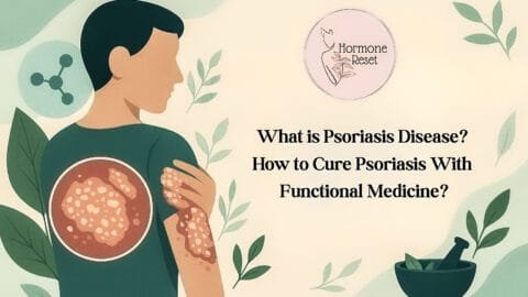 psoriasis
