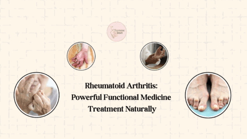 Rheumatoid Arthritis