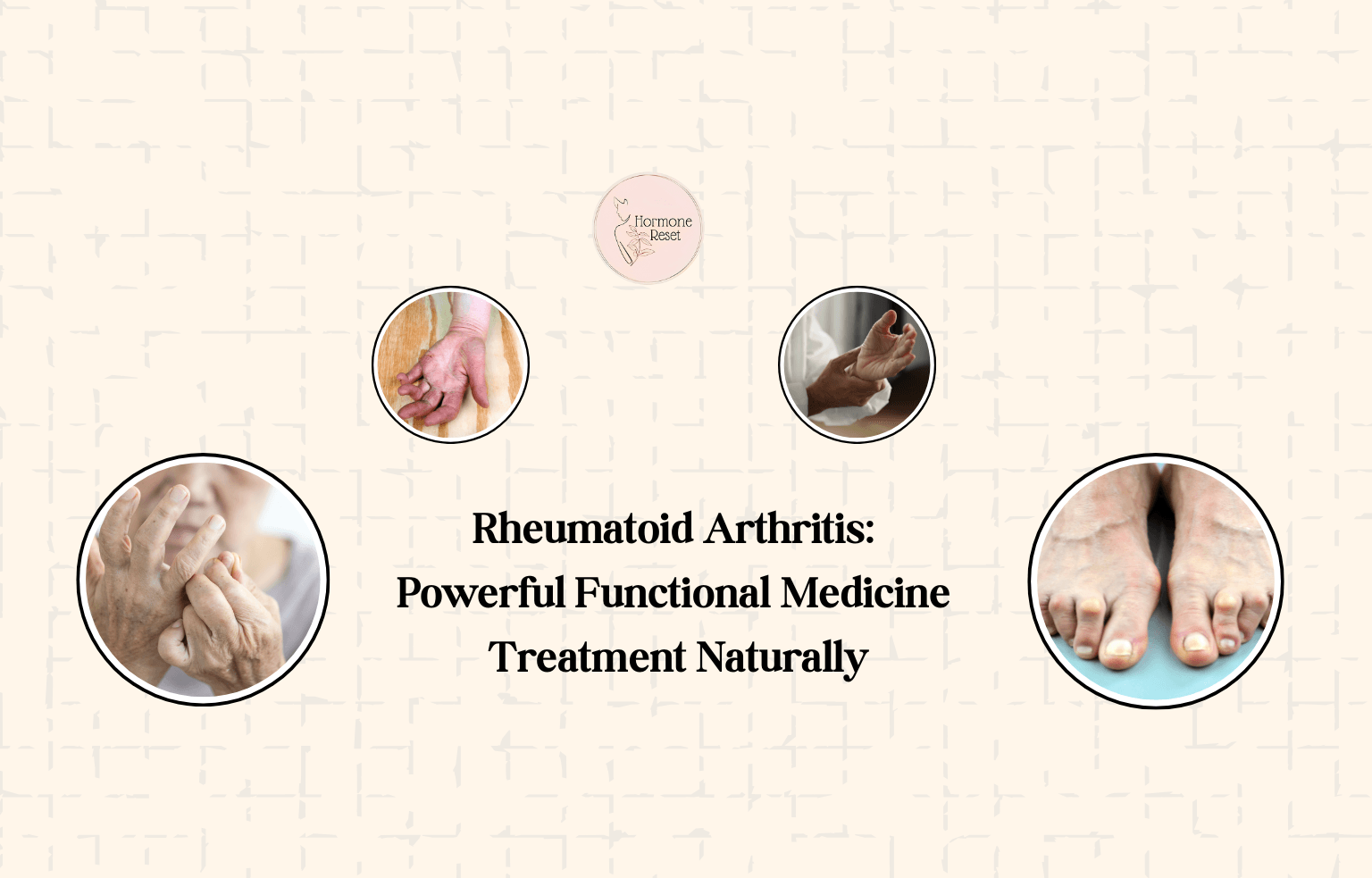 Rheumatoid Arthritis: Powerful Functional Medicine Treatment Naturally