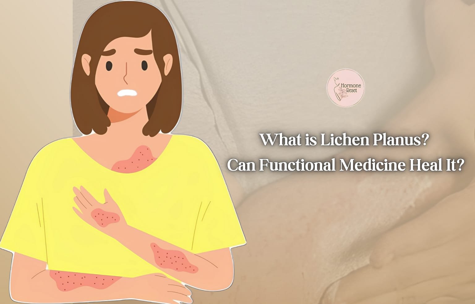 What is Lichen Planus? Can Functional Medicine Heal It?