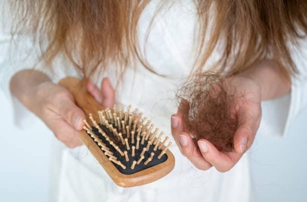 Breaking Down Alopecia: A Functional Medicine Viewpoint on Hair Loss 4 Alopecia